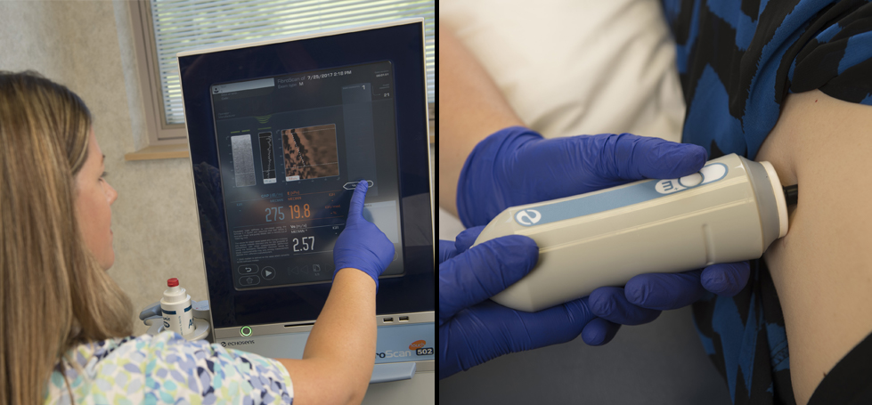 FibroScan&reg;